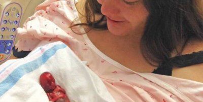 Dopo un aborto spontaneo, una madre si sorprende vedendo un “bambino perfettamente formato”