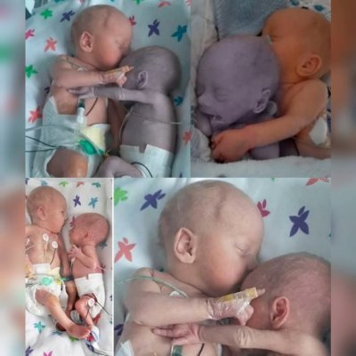 ČUDO DODIRA I ZAGRLJAJA