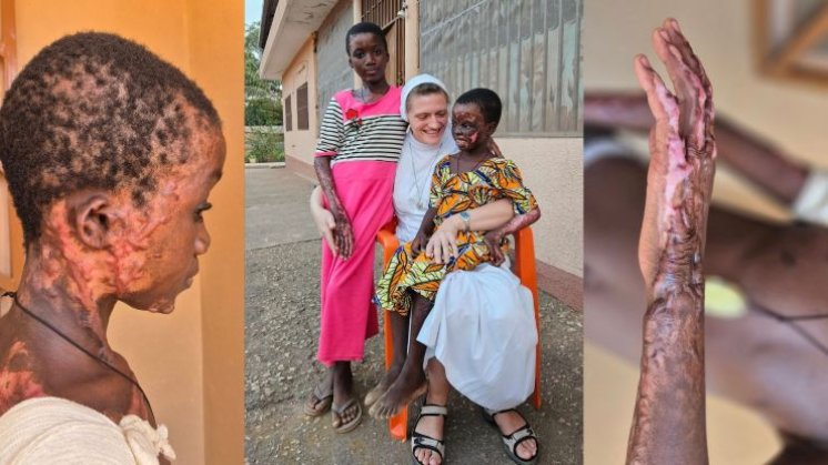 Dvije stradale djevojčice u Beninu trebaju našu pomoć &ndash; dovedimo ih u Hrvatsku